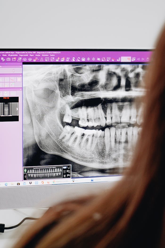 about-us A close-up of a dentist reviewing a dental X-ray image on a computer screen, focusing on oral health analysis.